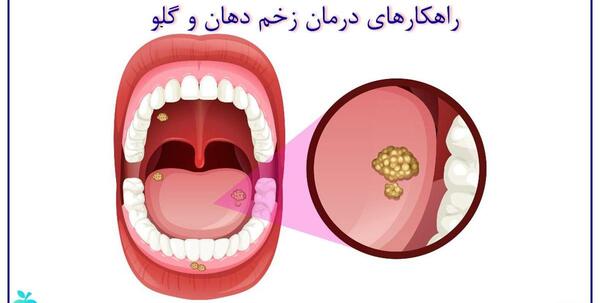 عکس قرمز شدن گلو
