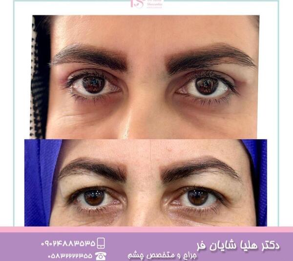 عکس e چشم پزشکی