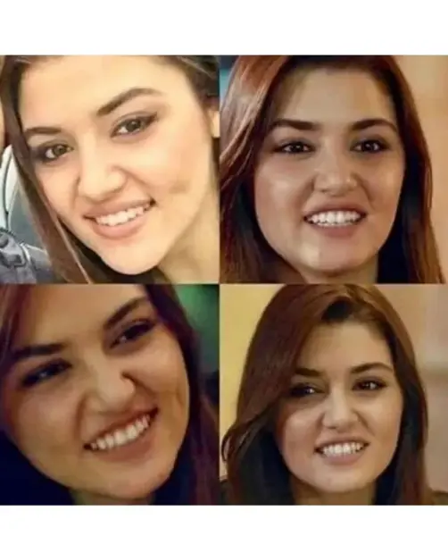 عکس هانده در حال خنده