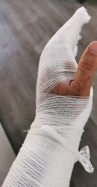 عکس چاقو خوردن دست