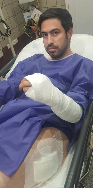 عکس چاقو خوردن دست