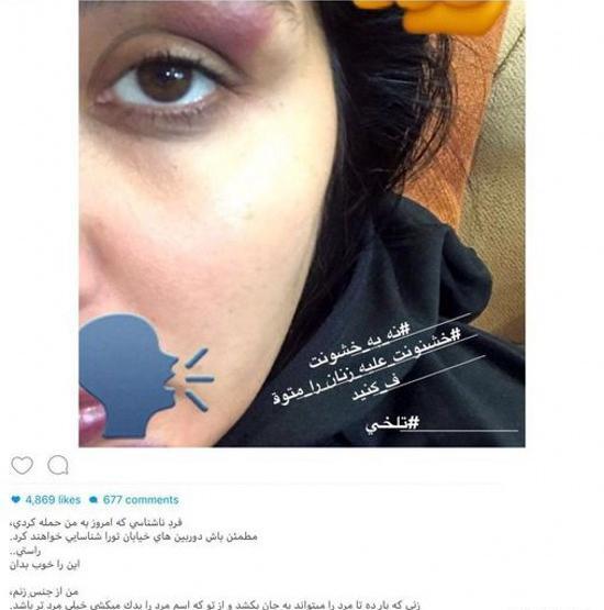 عکس چشم کبود دختر