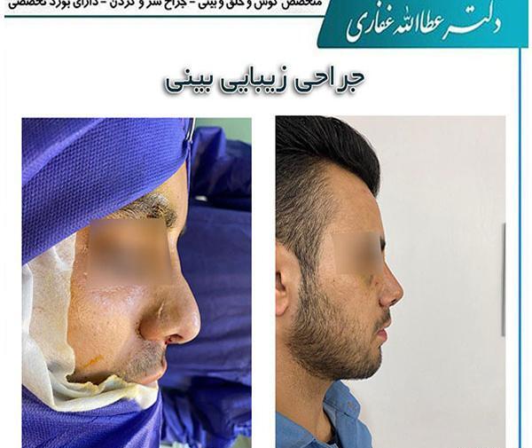 عکس سینا غفاری
