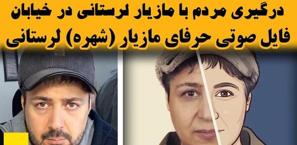 عکس شهره لرستانی بعد از عمل