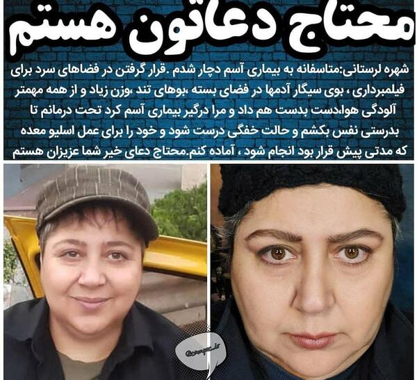 عکس شهره لرستانی بعد از عمل