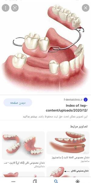 عکس دندان نی نی سایت