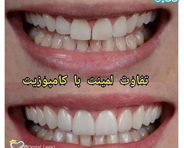 عکس دندان نی نی سایت