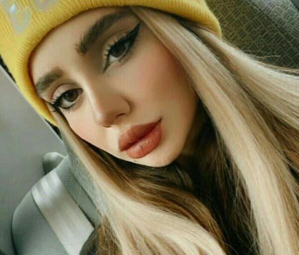 عکس نیکا فلاحی قبل از عمل زیبایی