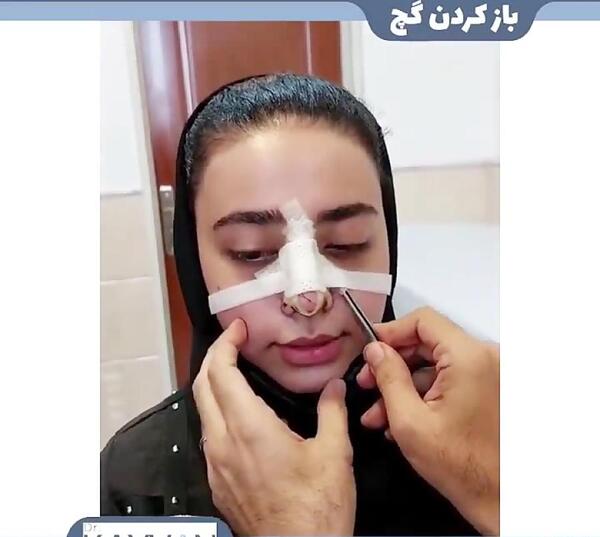 عکس ثانیه بعد از عمل