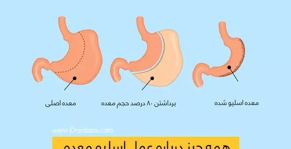 عکس ثانیه بعد از عمل