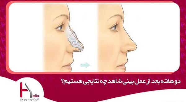 عکس ثانیه بعد از عمل