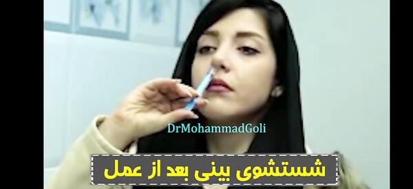 عکس ثانیه بعد از عمل