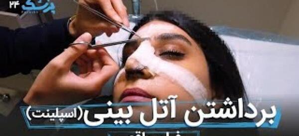 عکس ثانیه بعد از عمل