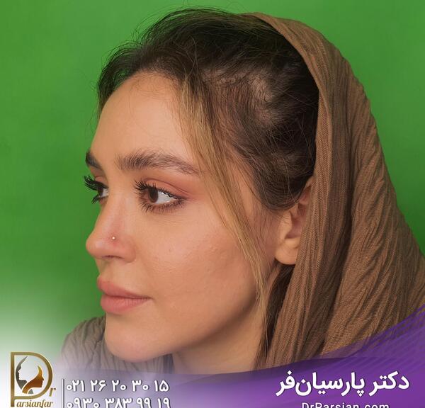 عکس های پیرسینگ بینی