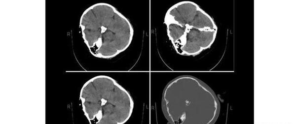 عکس ایران سیاه مهسا امینی