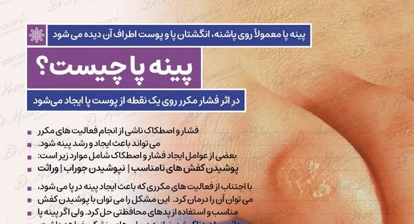 عکس میخچه پا