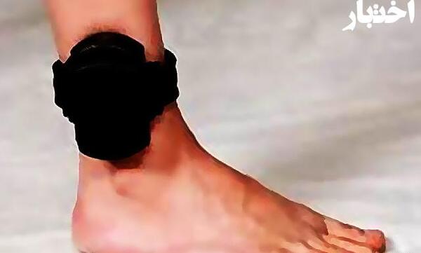 عکس های پابند الکترونیکی