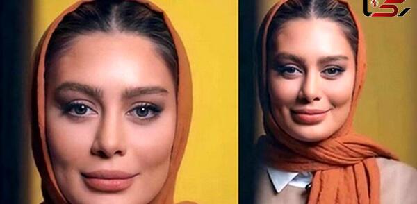 عکس کبودی