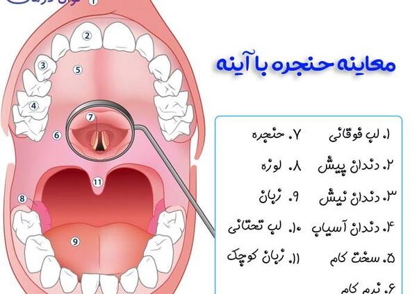 عکس حلق کنی