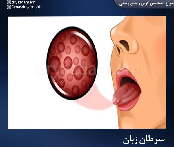 عکس حلق کنی