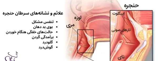 عکس حلق کنی