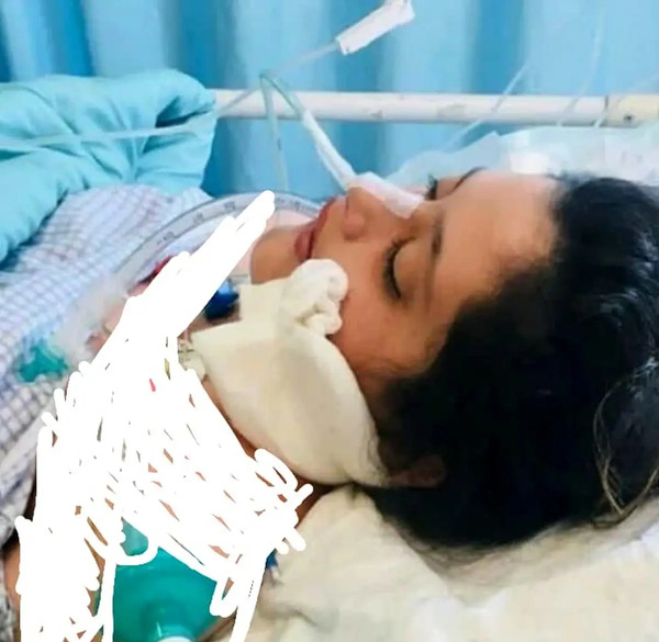 عکس جسد مهسا امینی در بیمارستان
