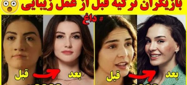 عکس زلیخا قبل از عمل در فیلم چوکوروا
