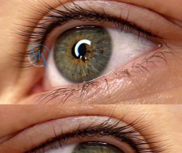 عکس بن مژه طبیعی