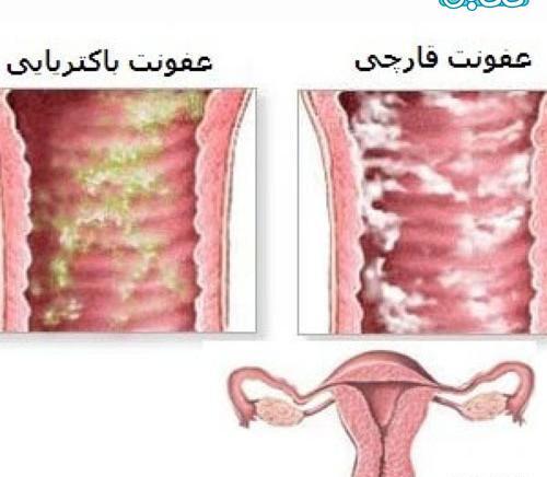 عکس ترشح نی نی سایت