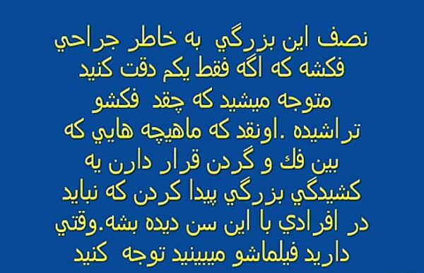 عکس کیم سو هیون قبل از عمل