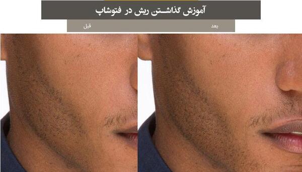 عکس گذاشتن ته ریش