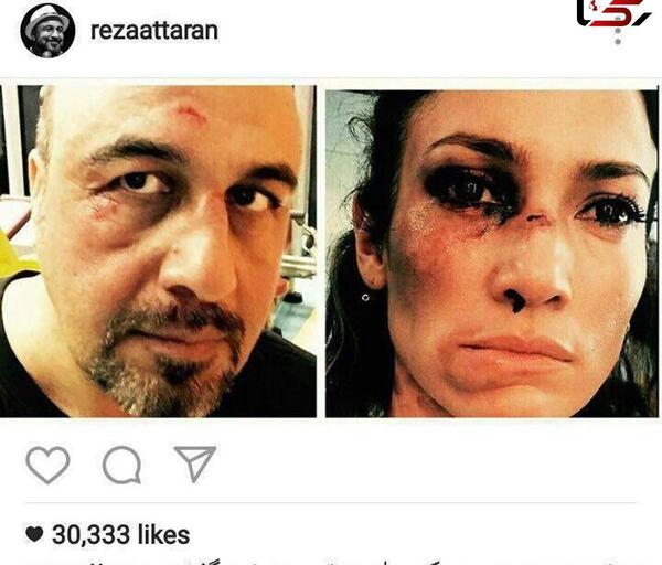 عکس مهدی کبودی