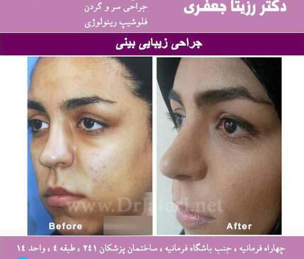 عکس مهدی کبودی