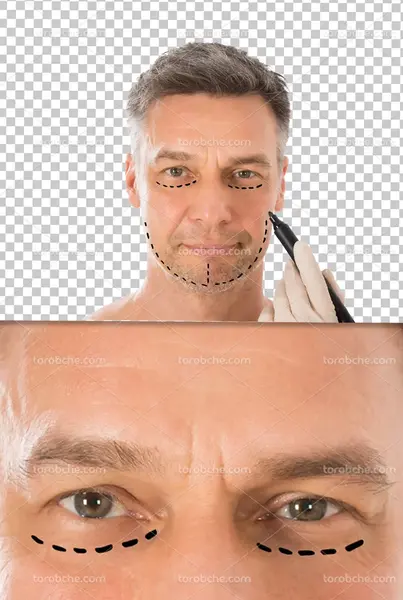 عکس لایه باز صورت