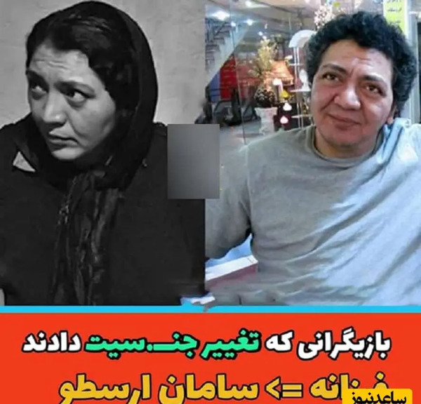 عکس ترنس ها قبل و بعد از عمل