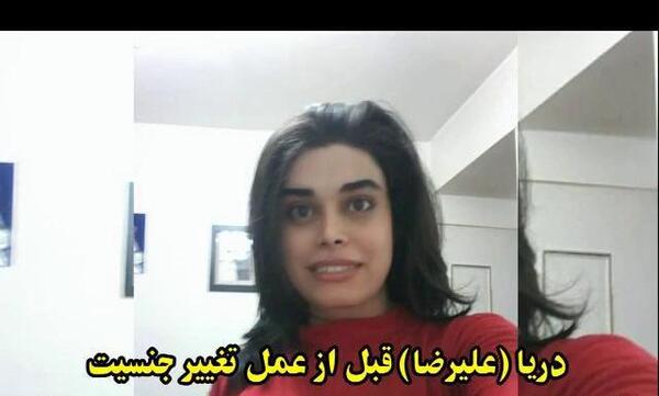 عکس ترنس ها قبل و بعد از عمل