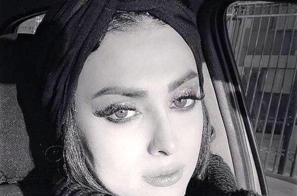 عکس ترنس ها قبل و بعد از عمل
