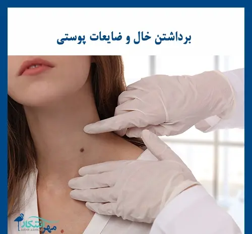 عکس دستگاه لیزر خال