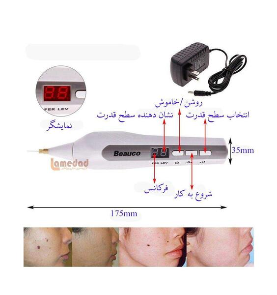 عکس دستگاه لیزر خال