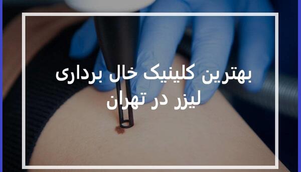 عکس دستگاه لیزر خال