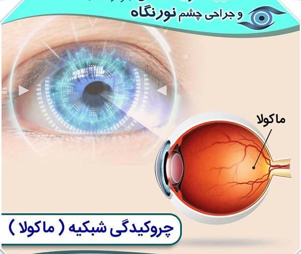 عکس صلبیه چشم