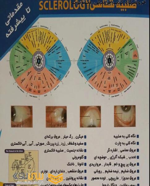 عکس صلبیه چشم