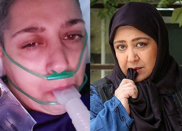 عکس شهره لرستانی بعد از تغییر