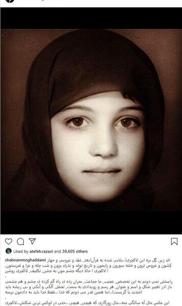 عکس ختنه نی نی سایت