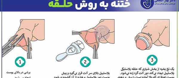 عکس ختنه نی نی سایت
