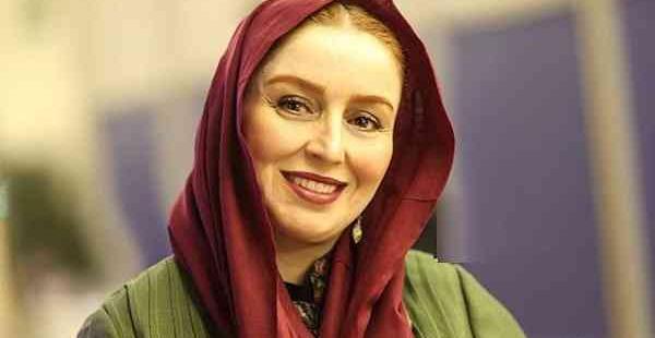 عکس ژاله صامتی بعد از عمل بینی