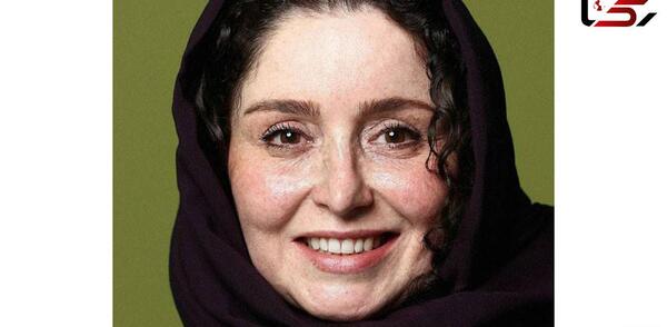 عکس ژاله صامتی بعد از عمل بینی