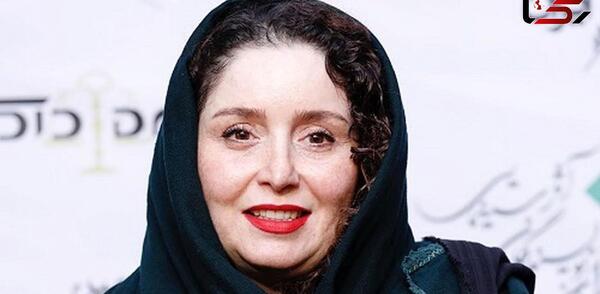 عکس ژاله صامتی بعد از عمل بینی