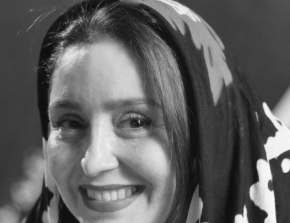 عکس ژاله صامتی بعد از عمل بینی