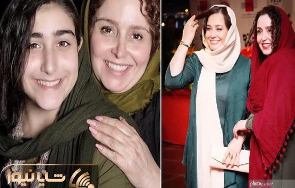 عکس ژاله صامتی بعد از عمل بینی